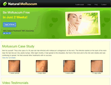 Tablet Screenshot of naturalmolluscum.com